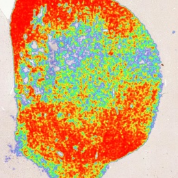Examples of tissue analysis delivered by Deep Learning AI technology Aiforia