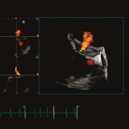Photo: Toshiba beams in on cardiology ultrasound