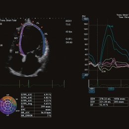 Photo: Toshiba beams in on cardiology ultrasound