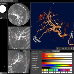 Canon Medical’s angiography systems are designed for maximum flexibility,...