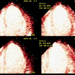 Photo: Cardio-controversy: Added value through CAD imaging?