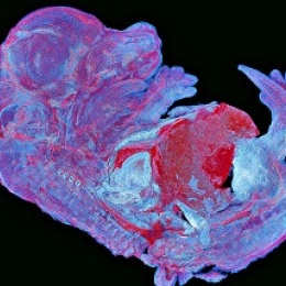 Asia-Pacific regional winner Howard Vindin - autofluorescence image of a mouse...