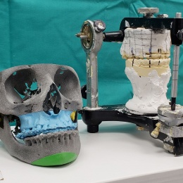 3D planning in orthognathic surgery replaced the old method in which...
