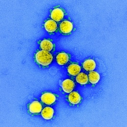 Photo: Does beautifying the Coronavirus make us underestimate its danger?