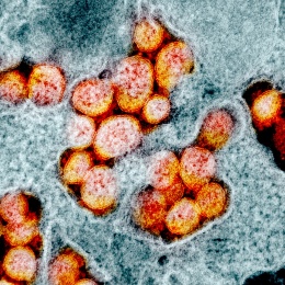 Photo: Does beautifying the Coronavirus make us underestimate its danger?