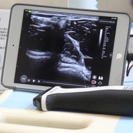 Mobile solutions, such as portable ultrasound transducers, were a huge part of...