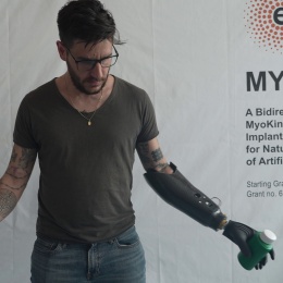 Experimental tests on robotic prosthesis: grip on bottle