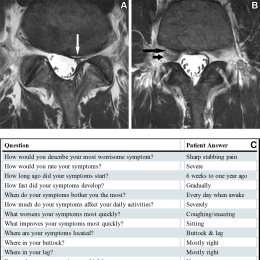 (A, B) Axial T2-weighted fast spin-echo MRI scans in a 42-year-old male...