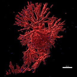 Sternartiges Tumor-Organoid mit kugelförmiger Mitte und zahlreichen...