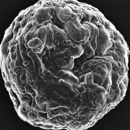 Gelatin sphere on which cells from the dermis grow. The image is taken using...