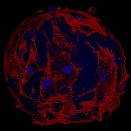 Gelatin sphere on which cells from the dermis grow. Cell nuclei are stained...