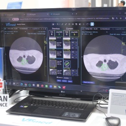 Photo: Medizintechnik mit Herz und Sorgfalt