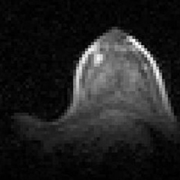 3D ultra-low field breast MRI obtained at 6.5 mT from a 31-year-old healthy...