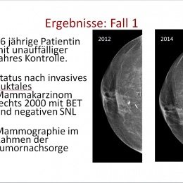 Mammographie der rechten Seite in der CC-Ebene. Datum steht. Man sieht 2014...