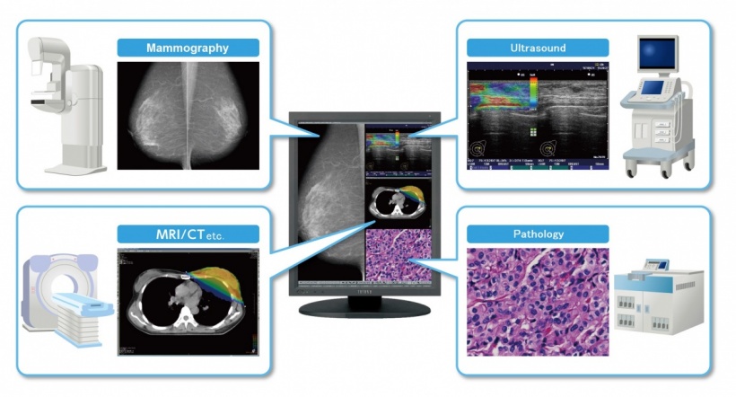 Ideally, Grayscale and colour images are displayed together on a monitor.