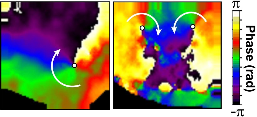 Optical mapping images of two different mouse hearts that developed ventricular...