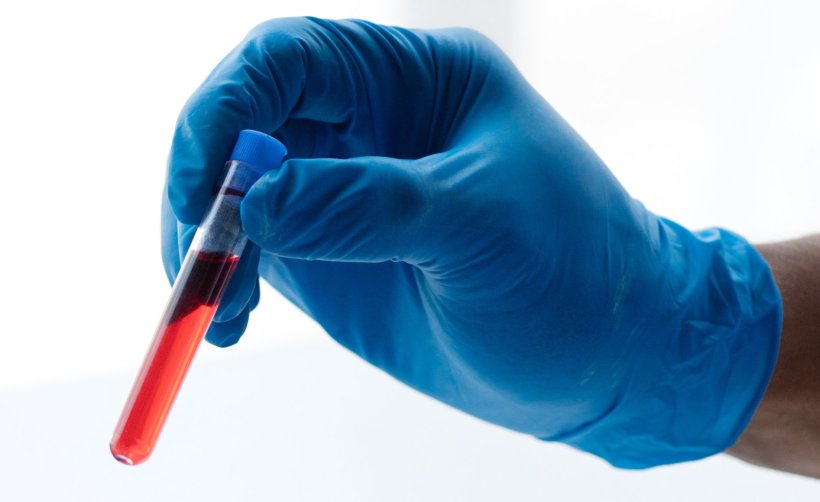 hand in blue rubber glove holding tube with blood sample