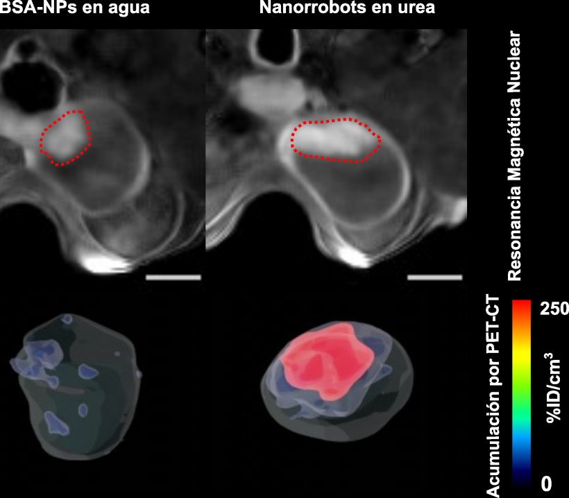 Bladder tumor localization through magnetic resonance imaging and accumulation...