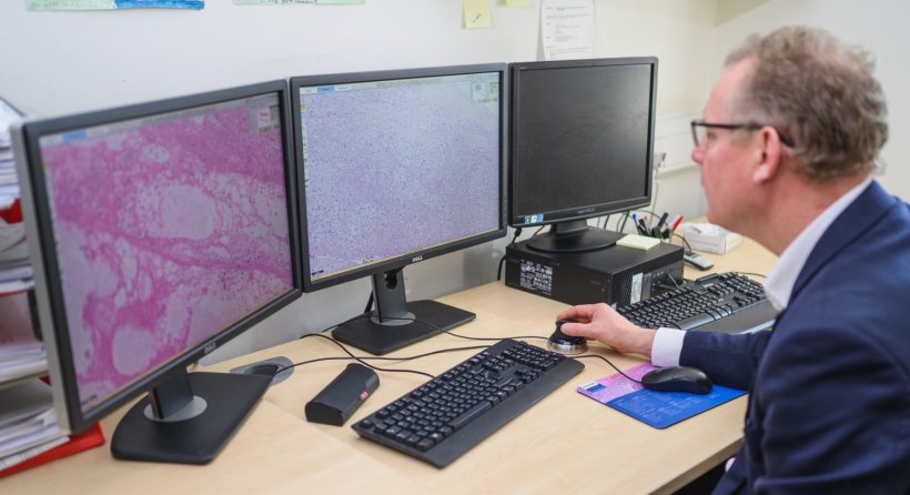 Digital pathology cleared for use in cancer screening programmes