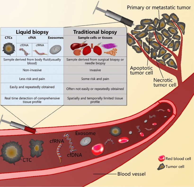 The difference between liquid biopsy and traditional biopsy