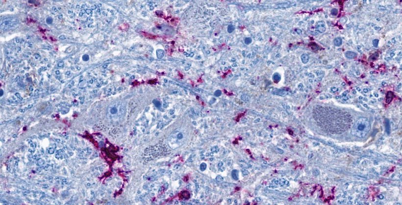 Ausschnitt aus dem Hirnstamm: Nervenzellen (graublau) stehen eng mit...