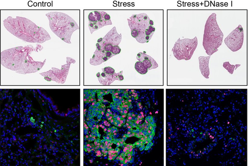 Cancer spread faster and more furiously in stressed mice (middle column) than...