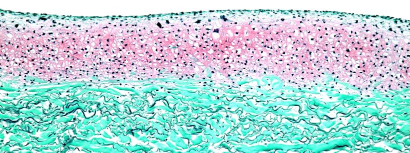 Histological staining (Safranin-O/Fast Green) of the finished cartilage...