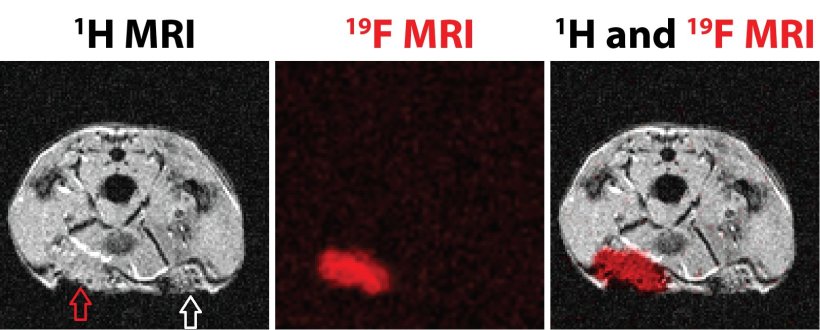 (Left) Classical magnetic resonance imaging of a rat (¹H MRI), a transverse...