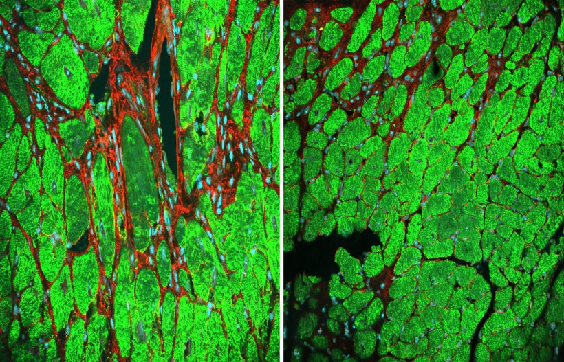 The microscopic image on the left shows a control mouse heart cross section...