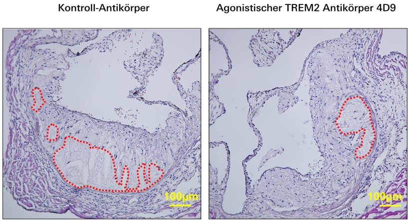 Die Behandlung mit dem agonistischen TREM2-Antikörper 4D9 führt zur...