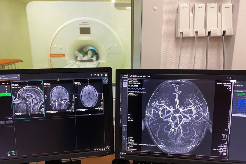 two monitors showing brain imaging from 7 tesla mri scanner, which can be seen...