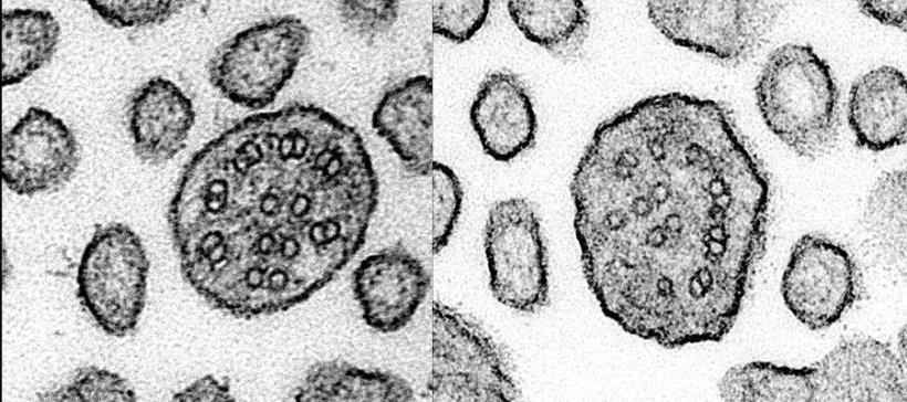 Transmission electron microscopy of TUBB4B mutant motile cilia axonemes in...