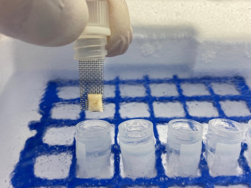 frozen tissue samples in medical laboratory