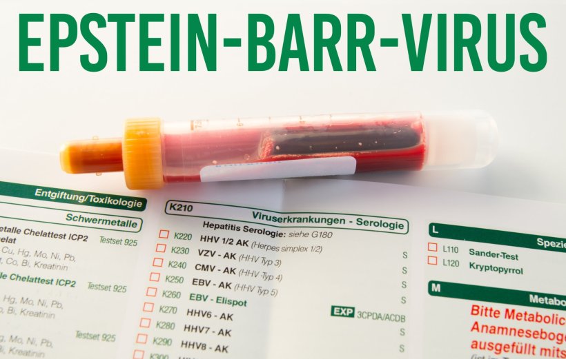 blood sample tube with label Epstein Barr Virus on diagnostic laboratory sheet