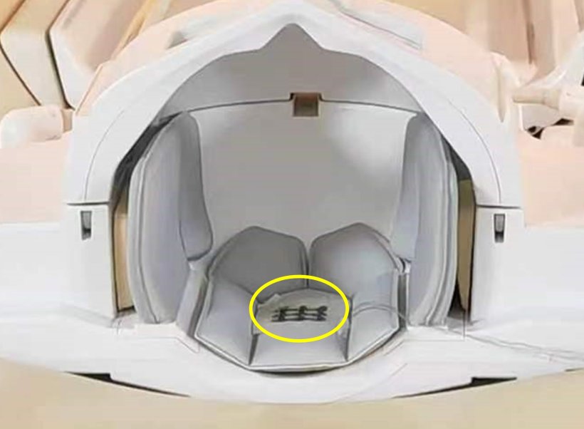 interior of MRI scanner, with new motion artifact sensor circled in yellow