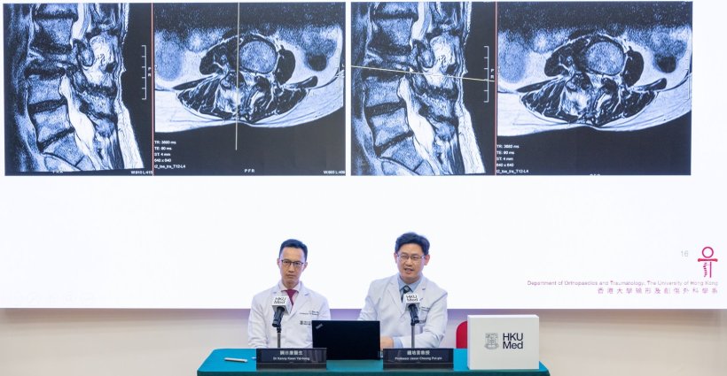 HKUMed researchers Professor Jason Cheung Pui-yin (right) and Dr Kenny Kwan...