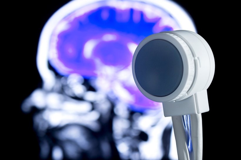 The 3D matrix ultrasound transducer for transcranial neurostimulation can...