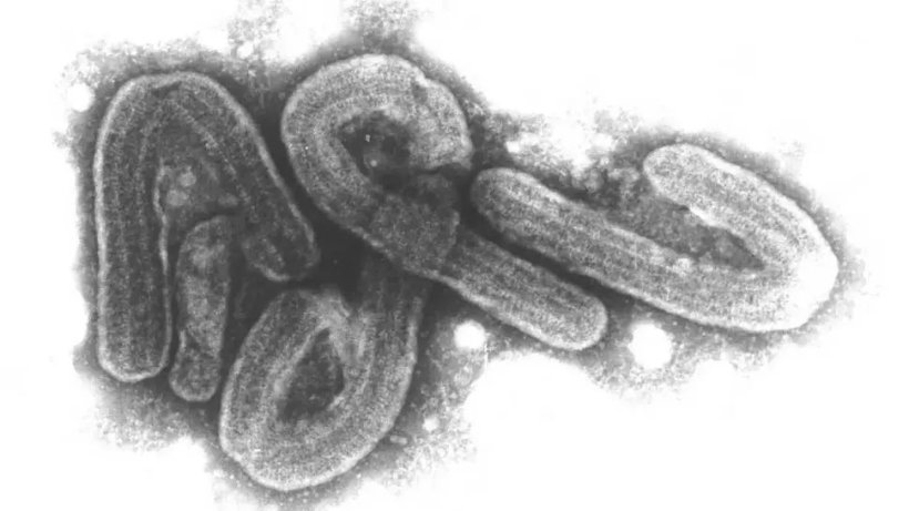 electron microscopy of marburg virus