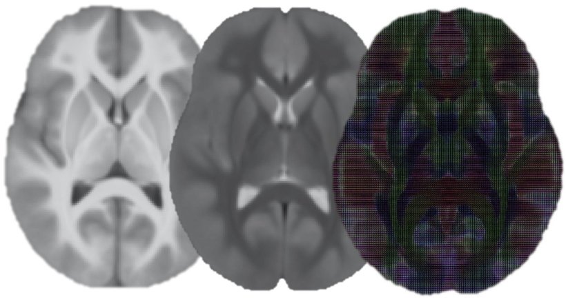 overlapping images of mri brain scans