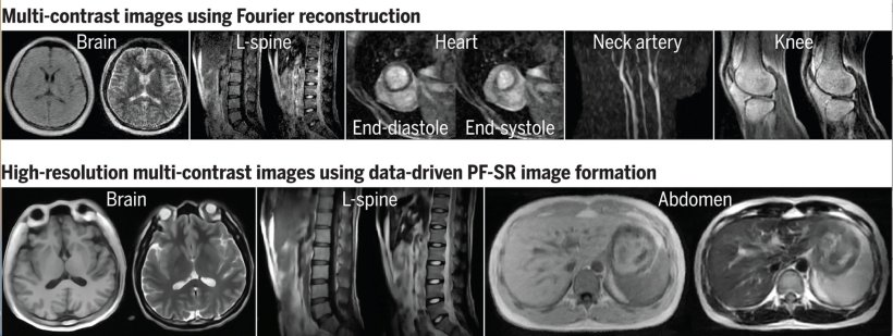 two rows of mri scans of different body parts taken with low field strength
