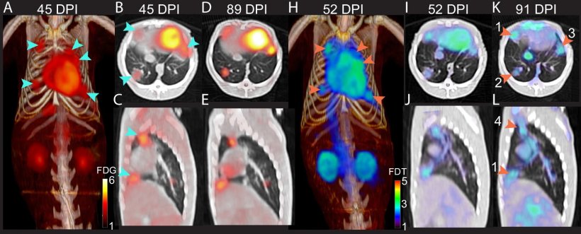 PET scan of marmoset lungs with specific radiotracer to detect tuberculosis...