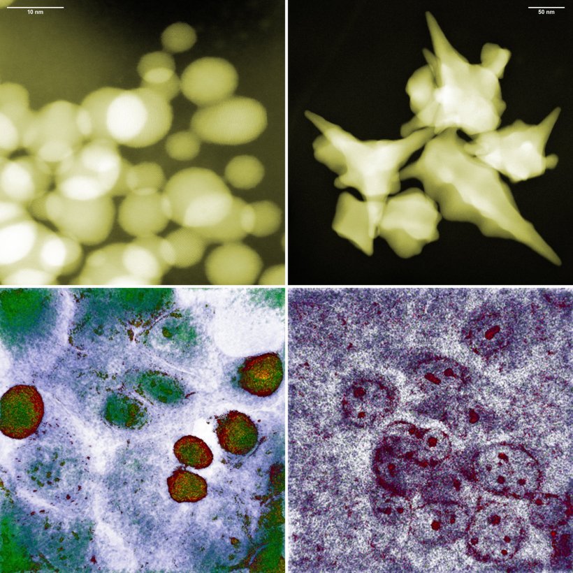 Spherical and star-shaped gold nanoparticles (top) and colon cancer cells after...