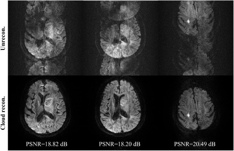 Two rows of MRI brain images, jittery scans above, reconstructed below