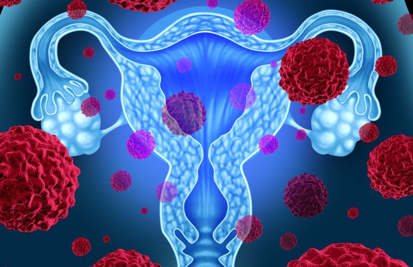 illustration of human uterus anatomy, overlaid with human papillomavirus...