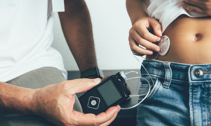 Ein Kind klebt den Sensor einer Insulinpumpe auf seinen Bauch. Neben ihm hält...