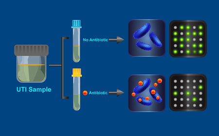 Die Illustration zeigt, wie der Antibiotika-Resistenztest funktioniert.