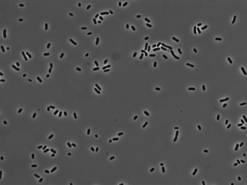 Microscopic image of Klebsiella pneumoniae bacteria