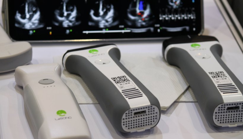 Three handheld ultrasound probes in front of a monitor displaying diagnostic...