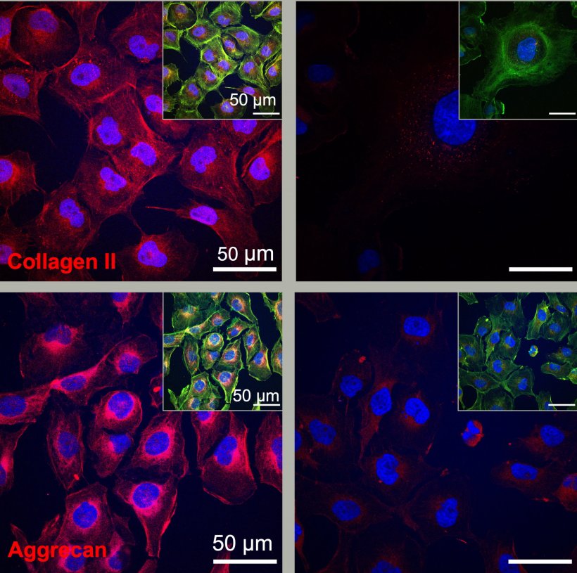 Cartilage cells generate more protein components (collagen II and aggrecan) for...