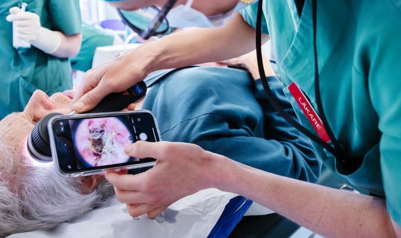 Dermatologists using a dermoscope during facial surgery